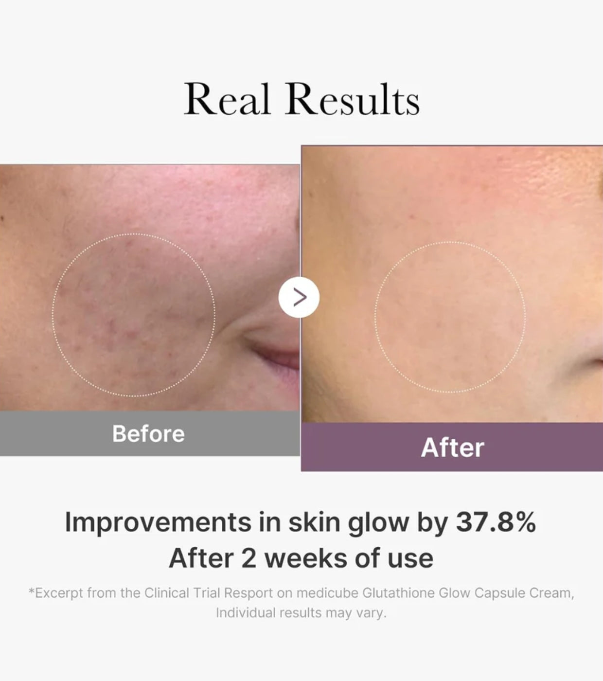 MEDICUBE Age-R Glutatión Glow Cápsula Crema