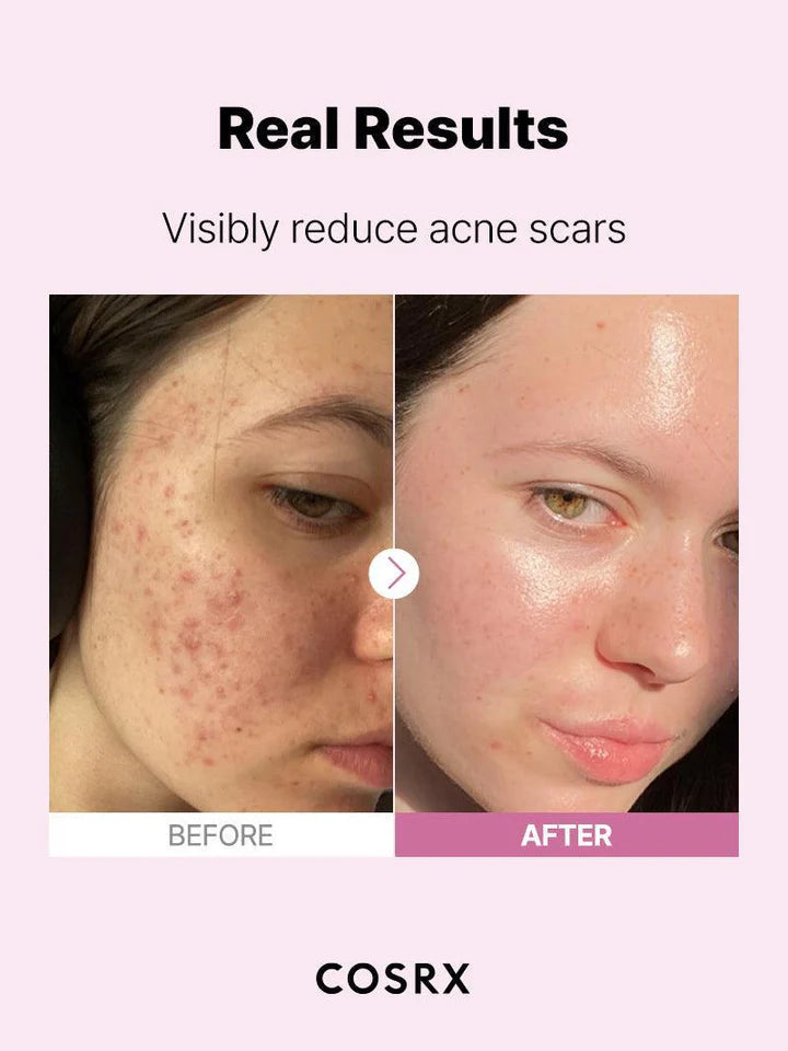 COSRX El suero de niacinamida 15